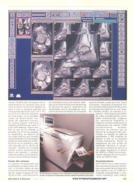 El fin de los rayos X - Febrero 1996